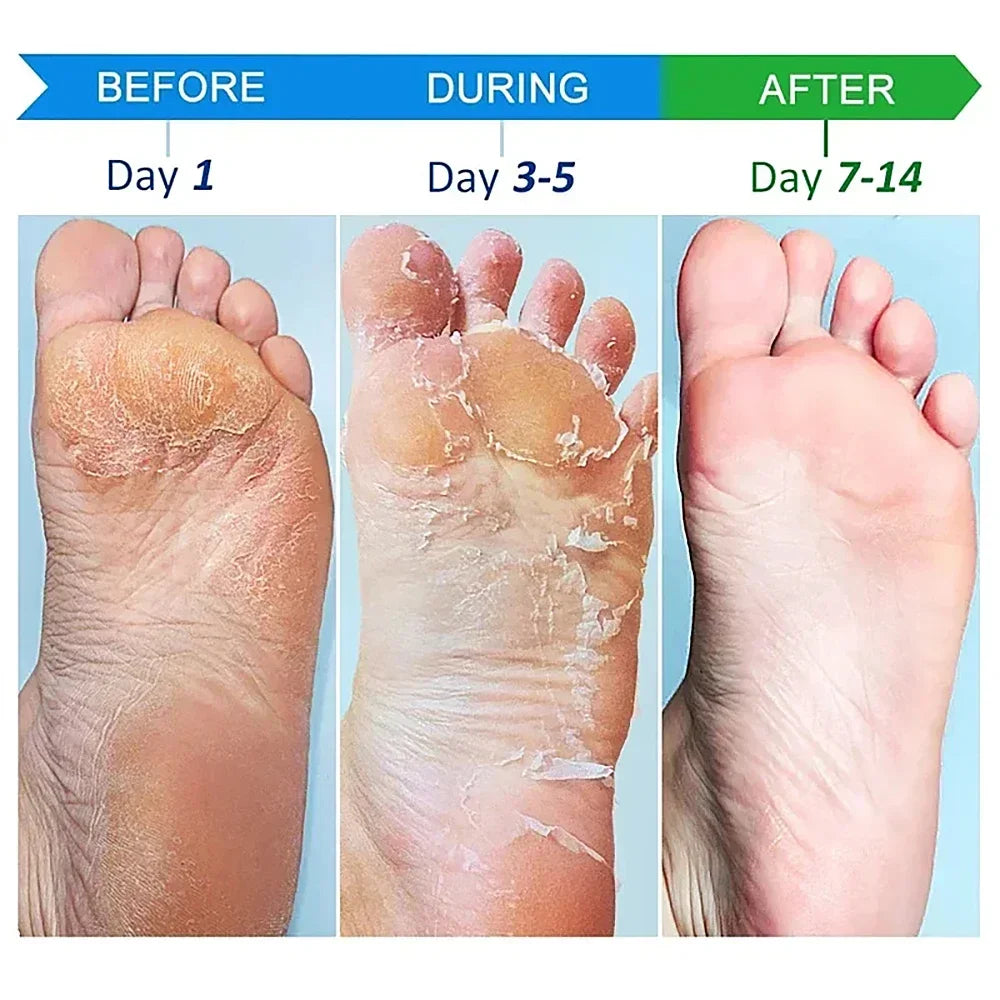 Tereno™ Wrinkle Removal Hand Cream
