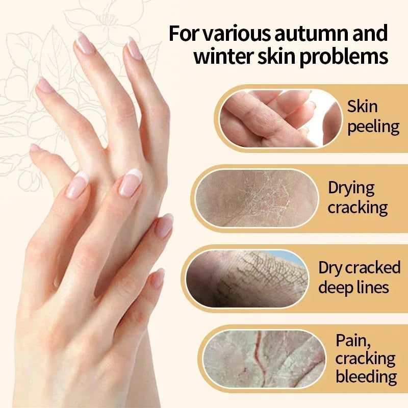 Tereno™ Wrinkle Removal Hand Cream