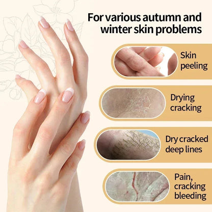 Tereno™ Wrinkle Removal Hand Cream